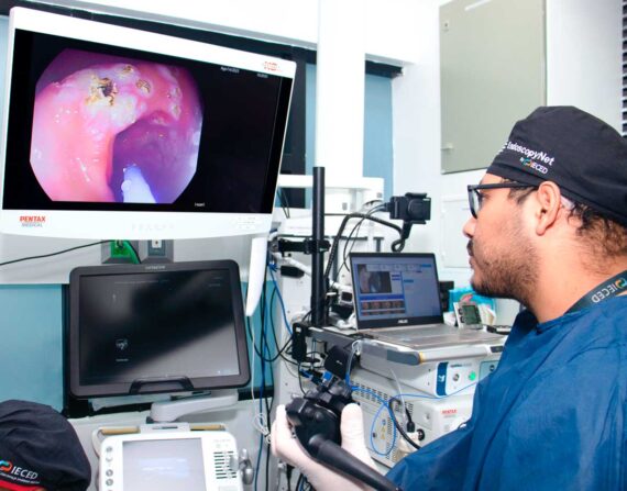 Endoscopía terapéutica coagulación con plasma argón